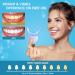 BESTEK Professional Teeth Whitening Kit - Fast 10 Min LED Whitening Non-Sensitive Carbamide Peroxide Formula for Stain Removal - Buy Online on GoSupps.com