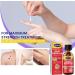 Wart Remover Liquid | Maximum Strength Gel Mask for Plantar & Common Warts | Safe & Natural Formula - Buy Online on GoSupps.com