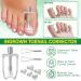 Ingrown Toenail Tools Kit - Stainless Steel Treatment & Corrector for Pain Relief | Pedicure Essentials - Buy Online on GoSupps.com