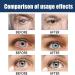 Buy Ourlyard Eye Drops - Effective Treatment for Vision Issues & Age-Related Eye Rehabilitation (1PC) - Buy Online on GoSupps.com