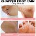 Cracked Heel Repair Cream Stick Foot Moisturizing Stick Foot Cream For Very Dry Feet Foot Cream For Calluses And Hard Skin Foot Moisturiser Callus Remover Soften For Feet Knees Hand - Buy Online on GoSupps.com