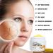 Lanthome Turmeric Face Cream - Anti-Aging Moisturizer for Skin, Acne Treatment, 50g - Buy Online on GoSupps.com