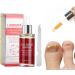 Nail Repair Essence 15ML Nail Fungus Treatment Natural Nail Care Toe Nail Fungus Treatment for Damaged Discolored Nails Antifungus Nail Treatment - Buy Online on GoSupps.com