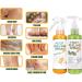 Foot Peeling Spray Orange Oil Foot Peeling Spray That Remove Dead Skin Tea Tree Foot Peeling Spray Remove Dead Skin within Seconds Exfoliator For Cracked Rough Heels Dry Toe Skin&Calluses (2Pcs) Orange+Green - Buy Online on GoSupps.com