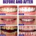 50g Tooth Powder Teeth Whitening Powder Probiotics Dazzling White Tooth Powder Natural Teeth Whitening Powder Stain Removal - Buy Online on GoSupps.com