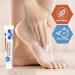 MED PRIDE 1% Clotrimazole Antifungal Cream - Effective Jock Itch Athletes Foot & Ringworm Treatment - Relieves Itching & Burning - 1oz International Shipping - Buy Online on GoSupps.com
