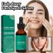  claircissant pour le visage 30 ml soin du visage quilibrant et rajeunissant id al pour les soins de nuit les voyages les femmes les soins de la peau et comme cadeau - Buy Online on GoSupps.com