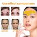 Forehead Wrinkle Remover Patch - Smooth Lines & Lift Skin with Hydrolyzed Collagen & Centella Asiatica - Buy Online on GoSupps.com