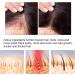 Saksraar Hair Growth Essential Oil Saksraar S rum de Croissance de Cheveux Huile De Repousse des Cheveux Au Gingembre S rum anti-chute de cheveux Perte de Cheveux et Cheveux Effiler Traitement - Buy Online on GoSupps.com