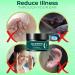 HEIMEABI 30g Tinnitus Ear Care Remover - Soothing & Relieving Green One Size - Buy Online on GoSupps.com