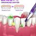 Liacsy Lot de 3 correcteurs de gencives blanches correcteur de gencives Liacsy stylo de blanchiment des dents violettes gel de th rapie des gencives correction de couleur pour enlever les taches - Buy Online on GoSupps.com