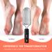 BEZOX Foot Scrubber - Stainless Steel Callus Remover for Smooth Feet | Effective Dead Skin Rasp - International Shipping Available - Buy Online on GoSupps.com
