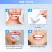 Professional Teeth Whitening Kit - Gel Pen Strips 32X LED Light Charging Case & Desensitizing Gel - Brighten Your Smile Anywhere - Buy Online on GoSupps.com