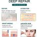 Medical Grade Silicone Scar Tape - 4CM x 150CM | Effective Scar Removal & Reusable for Keloid, Surgery & Acne - Waterproof & Soft Silicone Strips - Buy Online on GoSupps.com
