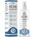 NOVEHA Facial Cleanser For Acne - Hypochlorous Acid Spray - Irritation Redness & Breakouts Relief - Ideal for Active Teenage & Adult Athletes Post-Workout - Safe for Multiple Daily Uses - 8 oz 8 Fl Oz (Pack of 1)