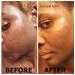 Aroma Depot Raw African Liquid Black Soap - 100% Natural for Acne, Eczema, Psoriasis - Handmade from Ghana - Gallon Size - Buy Online on GoSupps.com