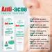 Salicylic Acid Face Moisturizer - Face Cream for Women - Acne Repair Face Cream - Spot Cream for Acne & Pimple - Moisturizer Face with Salicylic Acid - Improves Acne & Brightens Skin 20g - Buy Online on GoSupps.com