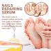 7 Days Nail Repair Essence - Thickening Nail Repair Liquid for Stronger Healthier and Beautiful Nails - International Shipping Available - Buy Online on GoSupps.com