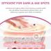 Dark Spot Remover for Face & Body Freckle Removal Cream Hyperpigmentation Treatment Freckle Removel Cream with Aloe Vera Hyaluronic Acid and Licorice Spot Cream Reduce Dark Spots & Soften Skin - Buy Online on GoSupps.com