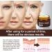 Anti-Wrinkle Face & Neck Retinol Cream with Hyaluronic Acid - Premium Anti-Aging Face Moisturizer - Anti Aging Firming Facial Cream to Reduce Wrinkles Dark Spots Fine Lines Sun Damage - Buy Online on GoSupps.com