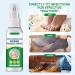 Extra Strength Athletes Foot Treatment Spray for Itchy, Inflamed, and Smelly Feet - 30ML (1FL.OZ) - Buy Online on GoSupps.com