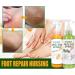 Foot Peeling Spray Orange Oil Exfoliating Foot Moisturizing Hydrating Nourish Peel Off Spray Remove Dead Skin And Calluses On Feet Gentle Foot Care. (Green Tea) - Buy Online on GoSupps.com