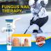 Fungal Nail Treatment Cream - Antifungal Solution for Toenail Repair & Discolored Nails - Buy Online on GoSupps.com