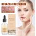 Rosacea Face Serum Anti Redness Face Serum for Women Relieve Redness & Acne Mark Dark Spot Correcting Glow Serum Anti Aging Serum for Face Hydrating Face Serum Skin Care for Women Dark Spots Remover - Buy Online on GoSupps.com