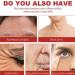 Dark Spot Correcting Serum Face Serum for Women Dark Correcting Serum Niacinamide Serum 10% Niacinamide+ 4% Tran-examic Acid Brightening Hydrating Face Serum Dark Spot Correcting Glow Serum Skincare - Buy Online on GoSupps.com