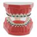 Orthodontic Model Dental Models 1:1 Standard Typodont Teeth Model M7010-2 Demo Teach Study with Archwire Ligature Ties Metal Brackets Buccal Tubes