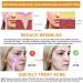 Twowin High Frequency Device for Acne Treatment & Skin Tightening | 60 Pcs Mull Masks Included - Shop Internationally! - Buy Online on GoSupps.com