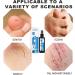 VKVWIV Spray Care for Inflammation 100ml Skin Relief Spray - White, One Size - Buy Online on GoSupps.com