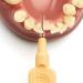 Tepe Interdental Brushes Extra Soft Orange (ISO Size 1: 0.45 mm) - Gentle & Efficient Cleaning for Healthy Gums - 8 Brushes (2 Pack) - International Shipping Available - Buy Online on GoSupps.com