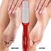 Probelle Double Sided Multidirectional Nickel Foot File Callus Remover - Instantly Eliminate Calluses and Corns - Safe and Effective (Red) - Buy Online on GoSupps.com
