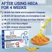 FEETT Heca Herbal Hemorrhoid Capsules - Fast Relief from Itching, Burning, and Pain (5pcs) - Buy Online on GoSupps.com