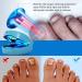 iKeener Laser Fungus Treatment Device - Buy Online on GoSupps.com