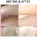Keratosis Pilaris Lotion Leg Keratosis Pilaris Treatment Body Cream Skin Exfoliating Repair Cream Chicken Skin Care Cream Exfoliating Skin Body Lotion for Reduce and Smoothen Rough & Red Bump - Buy Online on GoSupps.com