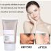 Azelaic Acid Cream Face Skin Care Beauty with Niacinamide & Vitamin C Azelaic Acid Suspension 10% Face Serum Reduce Blemishes Remove Acne&Rosacea Shrink Pore Face Cream for All Skin Types 30ML (1) - Buy Online on GoSupps.com