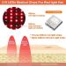 Bonnet De Croissance des Cheveux 215 LED 660 nm Et 850 nm R Glage 5 Vitesses + Synchronisation pour La Perte Cheveux/Favoriser Cheveux - Buy Online on GoSupps.com