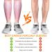 Calf Compression Sleeves for Women & Men 2 Pack Elastic Calf Support Footless Socks Ventilation Calf Brace for Pain Relief Sports Recovery Cycling Travelling Gym Calf Guards (Pink L) L Pink - Buy Online on GoSupps.com