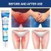 Antibacterial Ointment Anti-fungal Cream For Men and Women's groin Pruritus Cream For Private Parts Deodorizing Anti-Fungal Cream And anti-Fungal Cream For Quick itching 20g - Buy Online on GoSupps.com