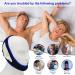 Adjustable Anti-Snoring Chin Strap for Men and Women - Keep Mouth Closed While Sleeping - Buy Online on GoSupps.com