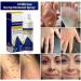  Bkljkf Soothing Spray for Skin Blemishes 60ml Natural Soothing Fast Absorbing Liquid Spray Care for Sensitive Skin for Women Men Teenagers and Young Adults - Buy Online on GoSupps.com