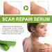 CRODY Goopgen Advanced Scar Repair Serum 30ml - Medical Scar Removal Treatment for Acne, Surgical Scars, Stretch Marks - 1pcs - Buy Online on GoSupps.com