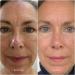 Buy The Youthful Copper Peptide Face Serum | Anti-Aging Hydration & Firmness - 30ML | International Shipping Available - Buy Online on GoSupps.com