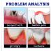 Oral Care Spray for Instant Toothache Relief - 20ML - Buy Online on GoSupps.com