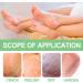 Trendyfave Foot Care Cream Foot Cream For Cracked Heels And Dry Skin Cracked Heel Repair Cream With Vitamin C And Aloe Vera For Deep Moisturizing Callus Remover And Soften Skin Care Hands & Feet - Buy Online on GoSupps.com