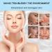 Tongyend Facial Moisturiser Skin Barrier Repair Moisturiser Face Women Dry Skin&Oil Skin&Rough Skin Repair Moisture Gel Daily Hydrating Face Cream for Women&Men Lightweight Enhance Skin Tolerance - Buy Online on GoSupps.com