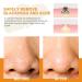 Blackhead Removal Nose Patches - Deep Cleansing Pore Strips for Instant Unclogging & Oil Removal (20 Patches - Buy Online on GoSupps.com