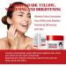 Kojic Acid Cream Dark Spot Remover for Face Skin Lightening Cream for Anti Aging Dark Spot Correcting Glow Serum Face Moisturizer for Women Pigmentation Removal Cream Freckle Removal Cream Dark Spots - Buy Online on GoSupps.com